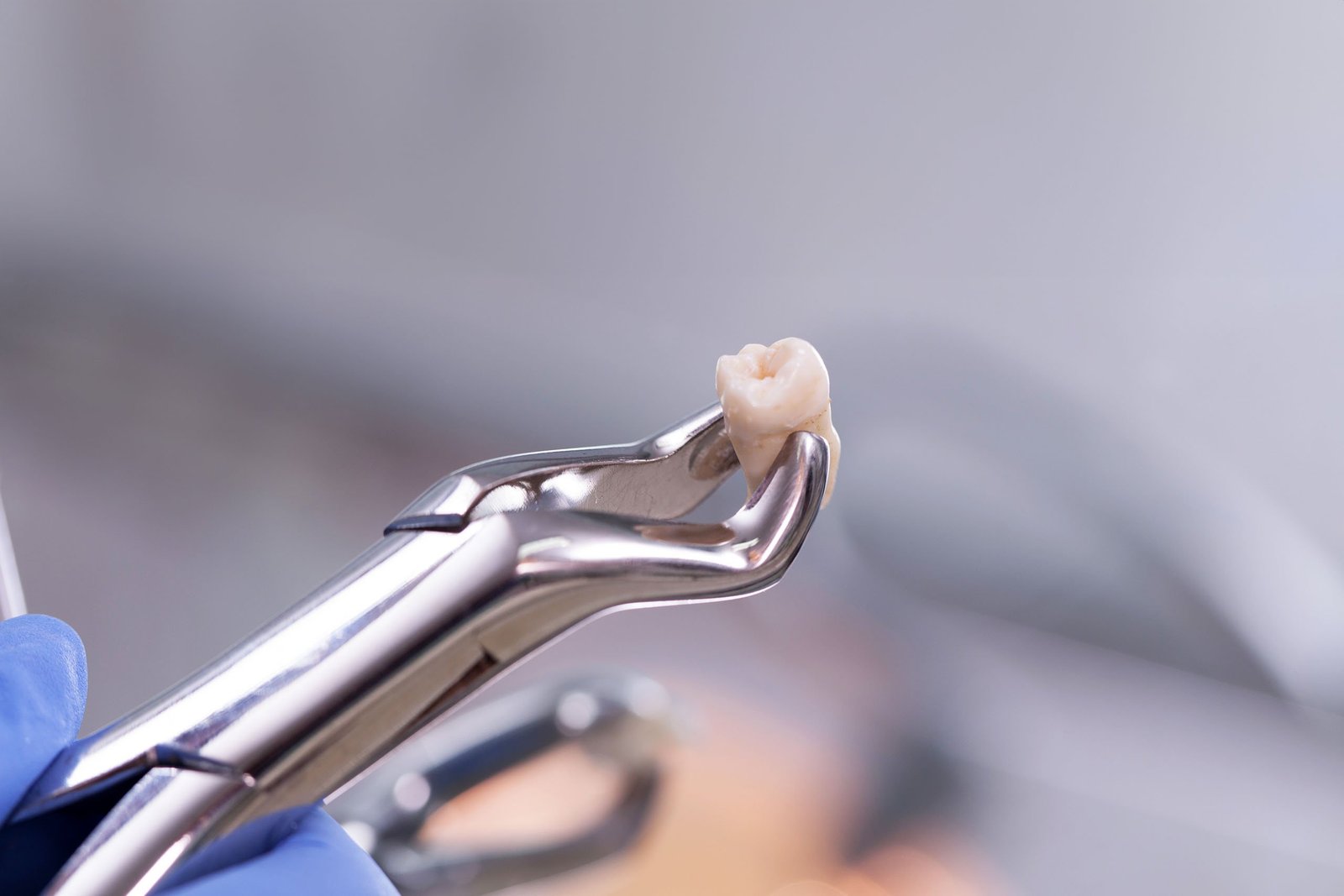 Stop Post Extraction Bleeding - Placerville Emergency Dentist
