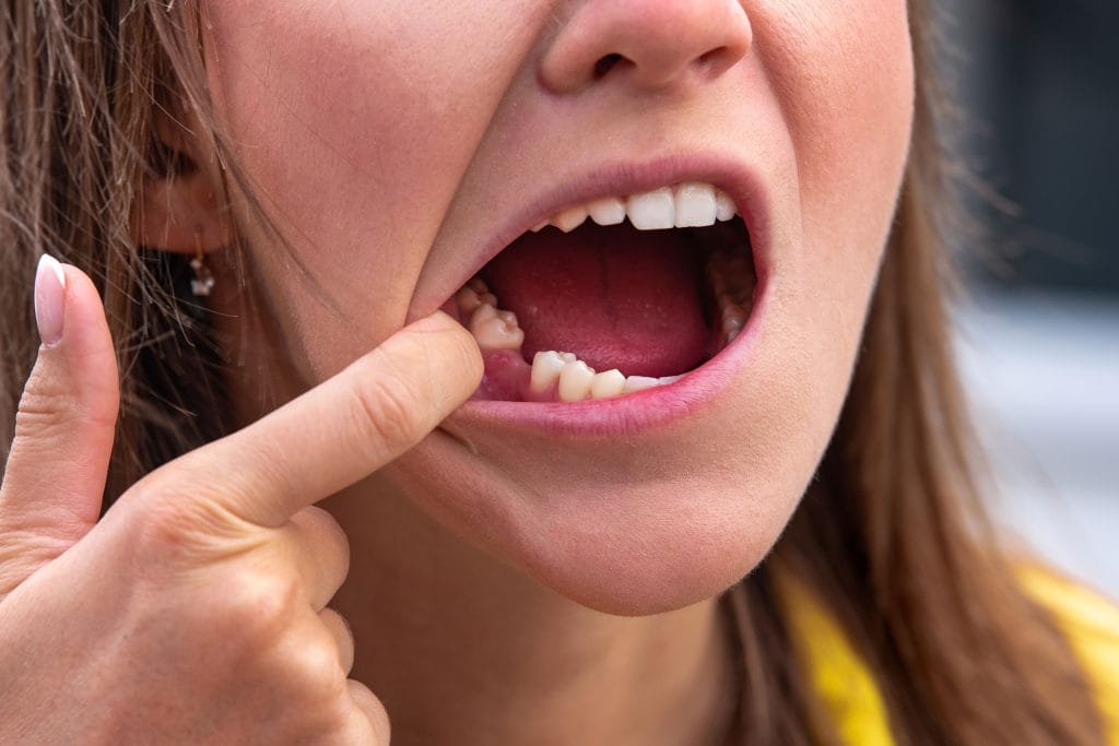 Tooth Emergency