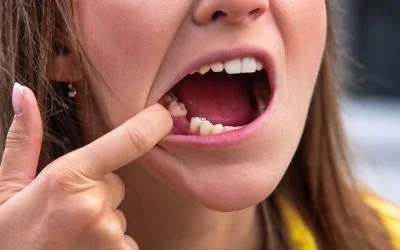 Tooth Emergency