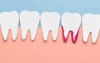 When Bleeding Gums Become a Dental Emergency