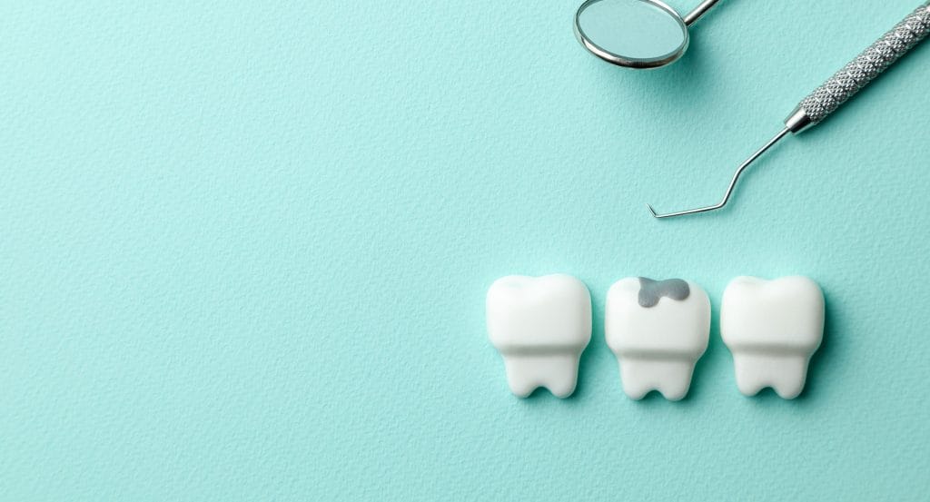 Frustrated by Failing Fillings?