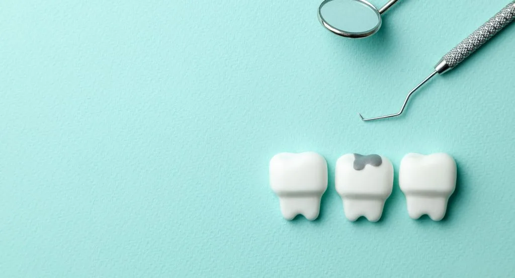 Frustrated by Failing Fillings?