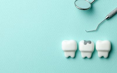 Frustrated by Failing Fillings?