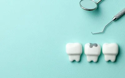 Frustrated by Failing Fillings?