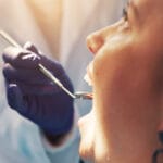 Dentist wearing gloves examines a patient’s open mouth with a dental mirror during an in-office checkup.
